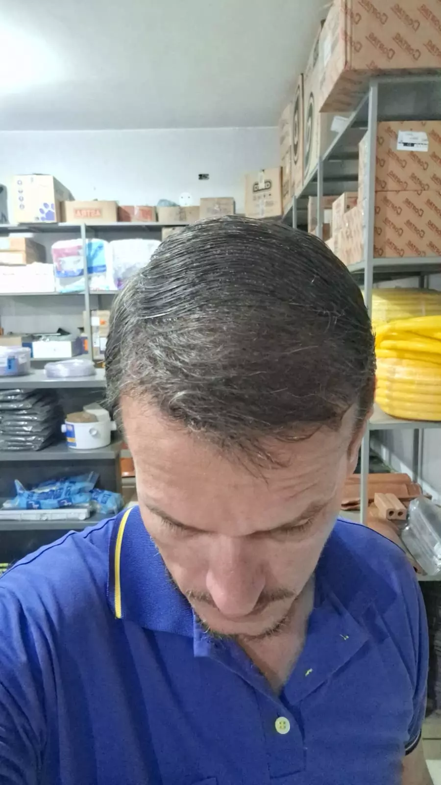 Depois do tratamento capilar